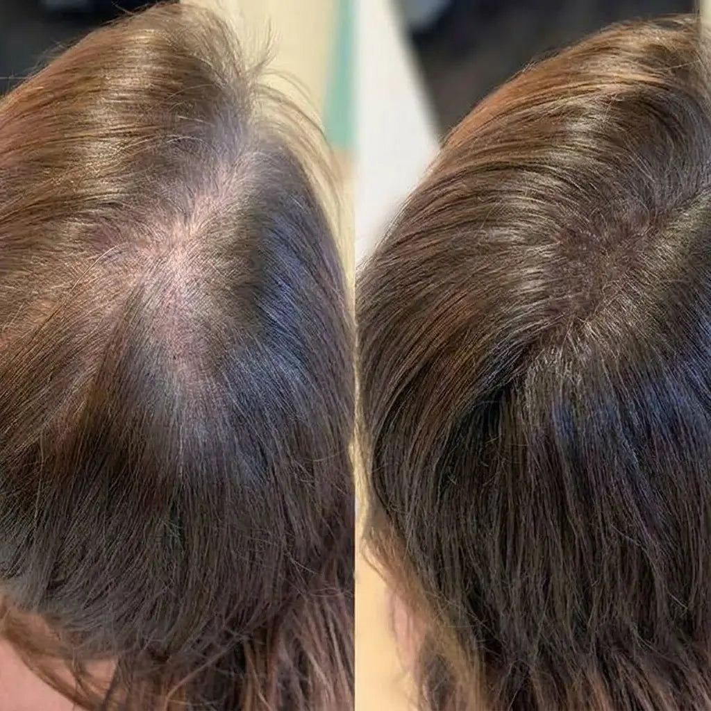 Deoxyribose Scalp Serum™