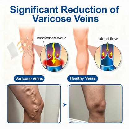 Rivnora®Vein Ease Microneedle Care Patch Instant Relief, Long-Term Results