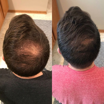 Deoxyribose Scalp Serum™