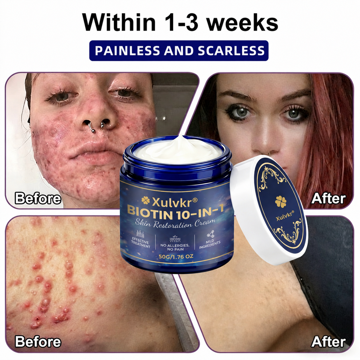 🍀 Xulvkr® Biotin 10-in-1 Skin Restoration Cream | Bigger 50g Jar, Upgraded Formula