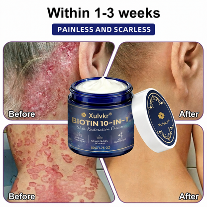 🍀 Xulvkr® Biotin 10-in-1 Skin Restoration Cream | Bigger 50g Jar, Upgraded Formula