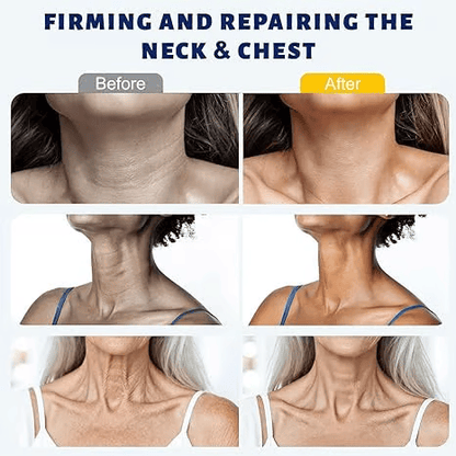 Instant Neck Lift Cream  — 🧴 Infused with Retinol & Hyaluronic Acid | Firms the Neck, Reduces Wrinkles & Double Chin