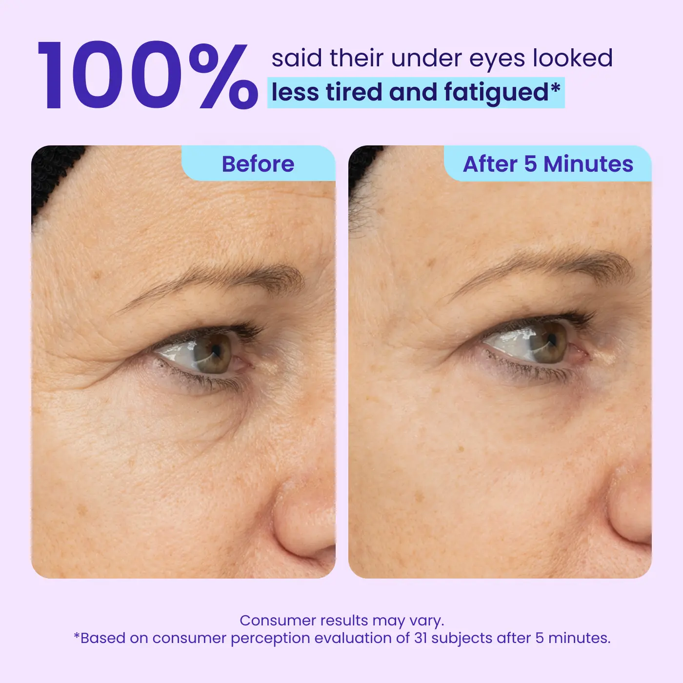 Final 3 Hours: 49%OFF🔥 Instant Lift Eye Gel for Puffiness, Bags & Dark Circles