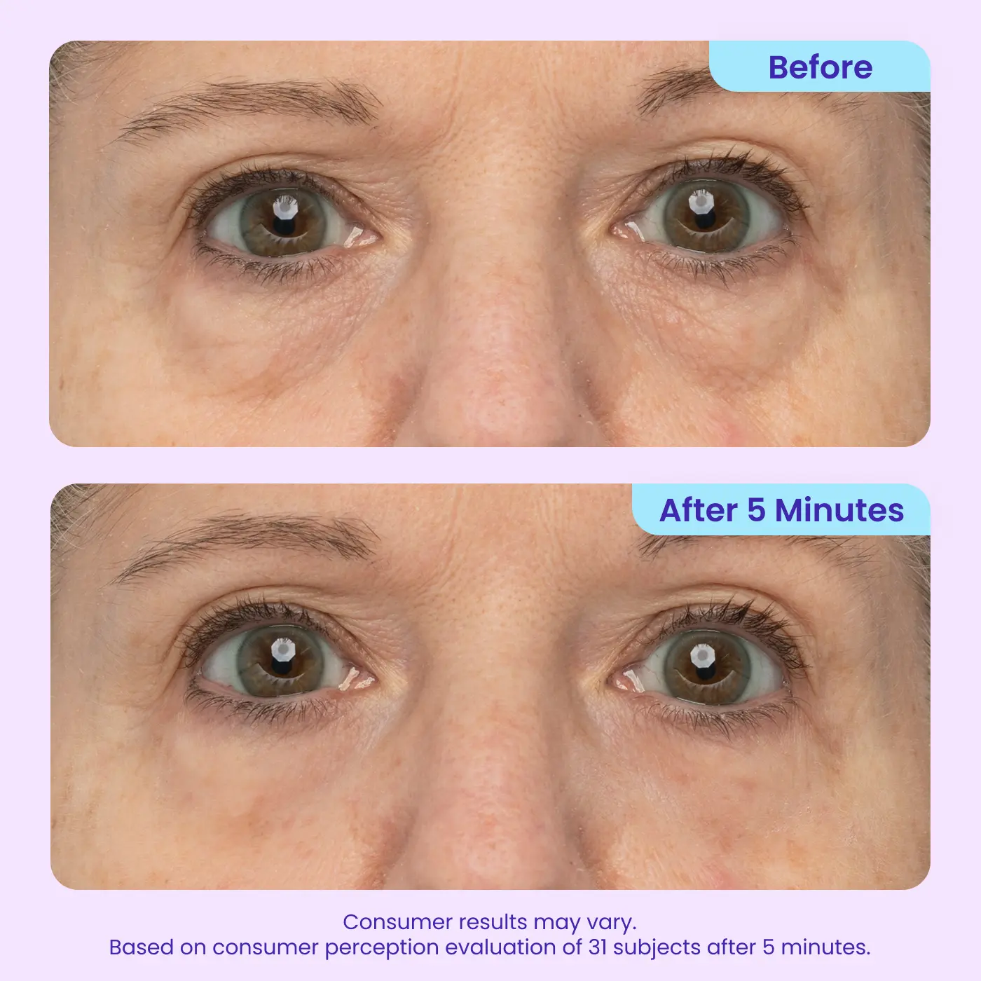 Final 3 Hours: 49%OFF🔥 Instant Lift Eye Gel for Puffiness, Bags & Dark Circles