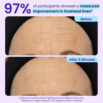 Final 3 Hours: 49%OFF🔥 Instant Lift Eye Gel for Puffiness, Bags & Dark Circles