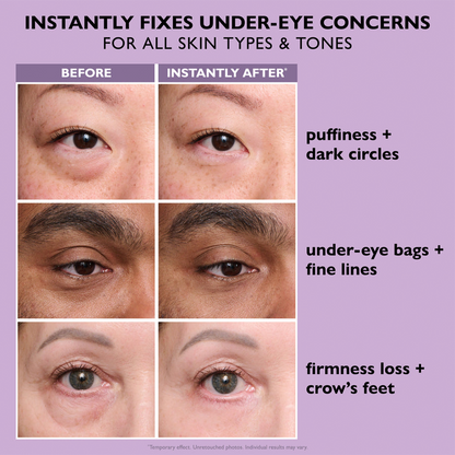 Final 3 Hours: 49%OFF🔥 Instant Lift Eye Gel for Puffiness, Bags & Dark Circles