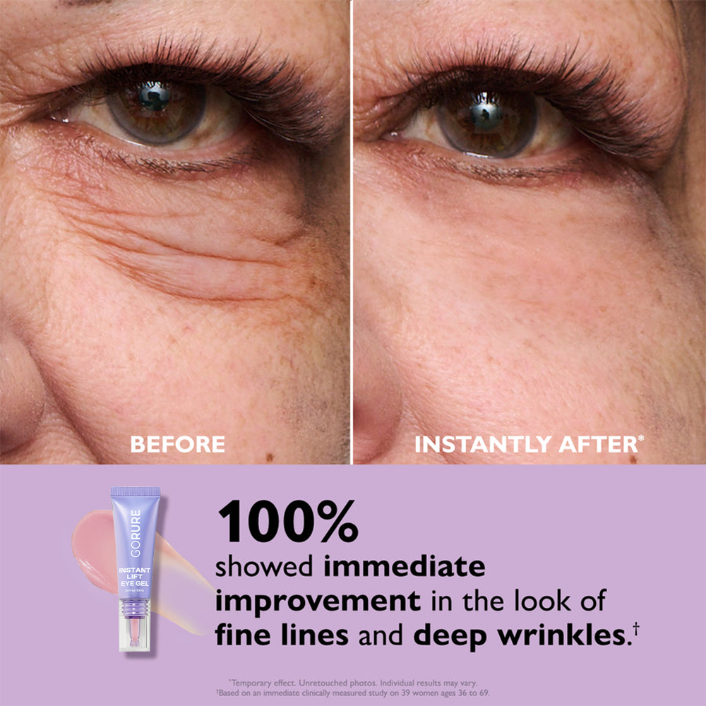 Final 3 Hours: 49%OFF🔥 Instant Lift Eye Gel for Puffiness, Bags & Dark Circles